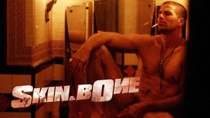 Skin & Bone