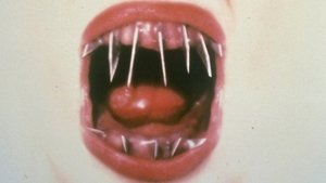 El Dentista 2