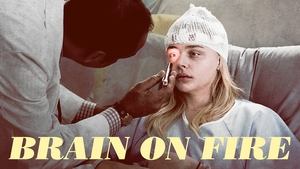 Brain on Fire