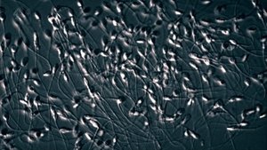 The Great Sperm Race